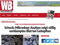 Bild zum Artikel: Schock: Mikroskop-Analyse zeigt völlig verklumptes Blut bei Geimpften