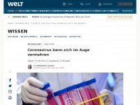 Bild zum Artikel: Coronavirus kann sich im Auge vermehren