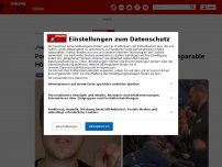 Bild zum Artikel: „Feige, hinterlistig und gefilmt“: Pocher spricht über Ohrfeige...