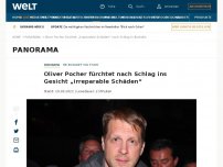 Bild zum Artikel: Oliver Pocher fürchtet nach Schlag ins Gesicht „irreparable Schäden“