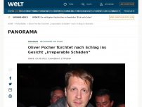 Bild zum Artikel: Oliver Pocher fürchtet nach Schlag ins Gesicht „irreparable Schäden“