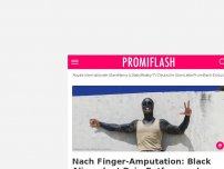 Bild zum Artikel: Nach Finger-Amputation: Black Alien plant Bein-Entfernung!