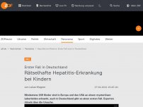 Bild zum Artikel: Rätselhafte Hepatitis-Erkrankung bei Kindern