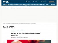 Bild zum Artikel: Erster Fall von Affenpocken in Deutschland bestätigt