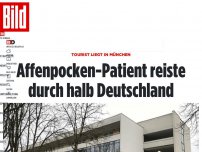 Bild zum Artikel: Tourist ist in München - Affenpocken-Patient reiste durch halb Deutschland