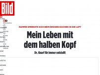 Bild zum Artikel: Leben mit halbem Kopf - Rapper Dr. Knarf sprengte sich selbst in die Luft