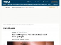 Bild zum Artikel: Zahl der Affenpocken-Fälle in Deutschland von 21 auf 33 gestiegen