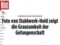 Bild zum Artikel: Schmerzen, Hunger, Verletzungen - Foto zeigt die Grausamkeit der Gefangenschaft