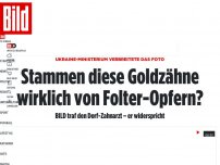 Bild zum Artikel: Ukraine-Ministerium verbreitete das Foto - Stammen diese Goldzähne wirklich von Folter-Opfern?