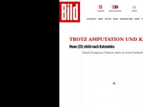 Bild zum Artikel: Trotz Amputation und Krankenhaus - 33-Jähriger stirbt nach Katzenbiss