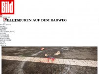 Bild zum Artikel: Böse Falle mitten auf dem Weg - Radler stürzt über E-Roller – tot!