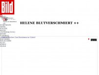 Bild zum Artikel: Auftritt in Hannover abgebrochen - Helene Fischer beim Konzert verletzt!
