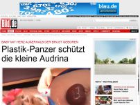 Bild zum Artikel: Plastik-Panzer schützt - Baby mit Herz außerhalb der Brust geboren