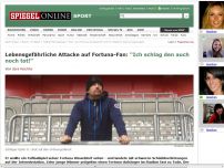 Bild zum Artikel: Lebensgefährliche Attacke auf Fortuna-Fan: 'Ich schlag den auch noch tot!'