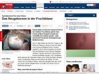 Bild zum Artikel: Spektakuläres Foto einer Geburt - Arzt postet Neugeborenes in Fruchtblase auf Facebook