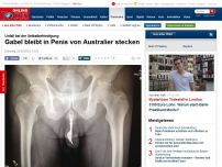 Bild zum Artikel: Unfall bei der Selbstbefriedigung - Gabel bleibt in Penis von Australier stecken
