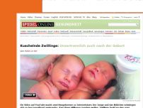 Bild zum Artikel: Kuschelnde Zwillinge: Unzertrennlich auch nach der Geburt