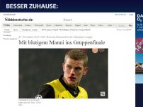 Bild zum Artikel: Borussia Dortmund in der Champions League: Mit blutigem Manni ins Gruppenfinale