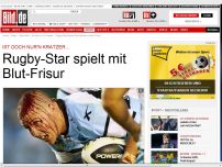 Bild zum Artikel: Ist doch nur'n Kratzer… - Rugby-Star spielt mit Blut-Frisur