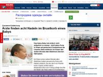 Bild zum Artikel: Grausame Entdeckung - Ärzte finden acht Nadeln im Brustkorb eines Babys