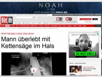Bild zum Artikel: Röntgenbild des Grauens - Mann überlebt mit Kettensäge im Hals