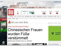 Bild zum Artikel: Damit sie einen Mann finden - Chinesischen Frauen wurden Füße verstümmelt