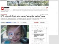 Bild zum Artikel: 'Störende' Narben: Dreijährige darf nach Pit-Bull-Angriff nicht bei KFC essen