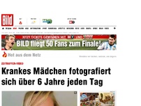 Bild zum Artikel: Krankes Mädchen - Sie fotografierte sich über 6 Jahre jeden Tag