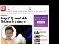 Bild zum Artikel: Horror-Unfall - Junge rammt sich Türklinke in Unterarm