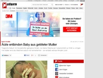 Bild zum Artikel: Nahost-Konflikt: Ärzte entbinden Baby aus getöteter Mutter