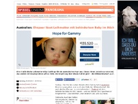 Bild zum Artikel: Australien: Ehepaar lässt Leihmutter mit behindertem Baby im Stich