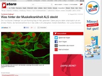 Bild zum Artikel: 'Ice Bucket Challenge': Was hinter der Muskelkrankheit ALS steckt