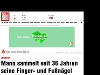 Bild zum Artikel: Iiiiiiiiiiiiih! - Mann sammelt seit 36 Jahren seine Nägel