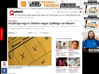 Bild zum Artikel: Kinderkrankheiten: Vierjähige stirbt an Spätfolge von Masern