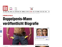 Bild zum Artikel: PHÄNOMEN DIPHALLIE - Doppelpenis-Mann veröffentlicht Biografie