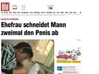 Bild zum Artikel: Wegen Seitensprung - Ehefrau schneidet Mann zweimal den Penis ab