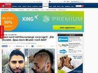 Bild zum Artikel: Er wollte nur schlichten - Mann wird mit Eisenstange verprügelt: „Ein Wunder, dass mein Bruder noch lebt“