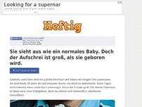 Bild zum Artikel: Sie sieht aus wie ein normales Baby. Doch der Aufschrei ist groß, als sie geboren wird.