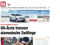 Bild zum Artikel: 26-Stunden-OP! - US-Ärzte trennen siamesische Zwillinge