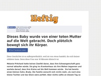 Bild zum Artikel: Dieses Baby wurde von einer toten Mutter auf die Welt gebracht. Doch plötzlich bewegt sich ihr...