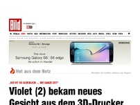 Bild zum Artikel: Tapfere Violet (2) - Mädchen bekam Gesicht aus dem 3D-Drucker