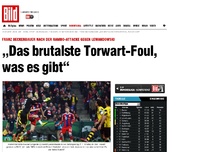 Bild zum Artikel: Franz Beckenbauer - „Das brutalste Torwart- Foul, was es gibt“