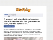 Bild zum Artikel: Er weigert sich standhaft aufzugeben: Dieses Baby überlebt den grausamsten Start, der nur...