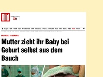 Bild zum Artikel: Erstmals in Europa - Mutter zieht Baby selbst aus Bauch