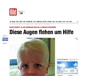 Bild zum Artikel: Krebs! - Diese Augen flehen um Hilfe