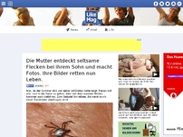 Bild zum Artikel: Die Mutter entdeckt seltsame Flecken bei ihrem Sohn und macht Fotos. Ihre Bilder retten nun Leben.