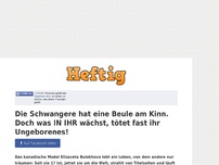 Bild zum Artikel: Die Schwangere hat eine Beule am Kinn. Doch was IN IHR wächst, tötet fast ihr Ungeborenes!