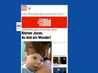 Bild zum Artikel: Baby mit halbem Schädel - Kleiner Jaxon, du bist ein Wunder!