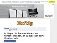 Bild zum Artikel: 24 Dinge, die Ärzte im Hintern von Menschen fanden. Nr. 21 tut schon beim Hinsehen weh.