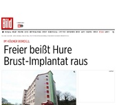Bild zum Artikel: Im Kölner Bordell - Freier beisst Hure Brust-Implantat raus